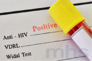 HK STD TEST, HIV Positive