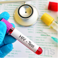 愛滋病病毒 HIV-test
