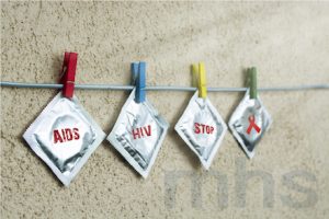 愛滋病病毒 (HIV) /愛滋病 (AIDS) 的治療